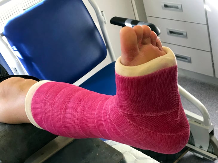 Broken bone