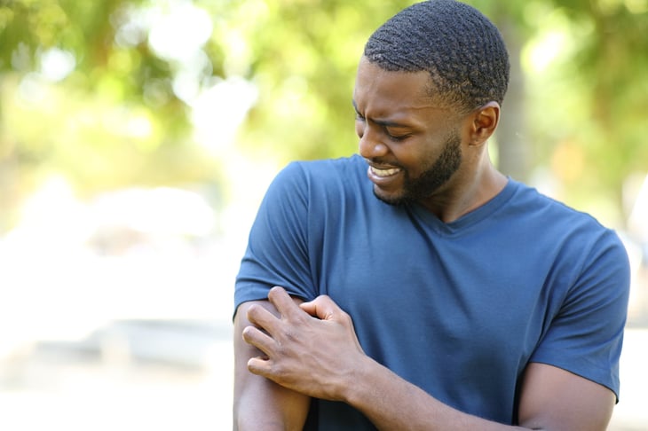 Man scratching mosquito bite